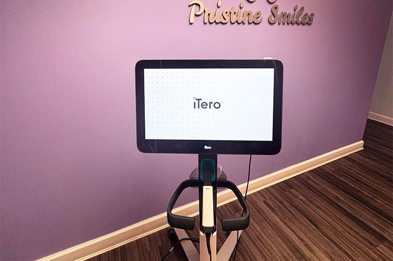 iTero Intra-Oral Scanner and Digital Impressions in Rockville