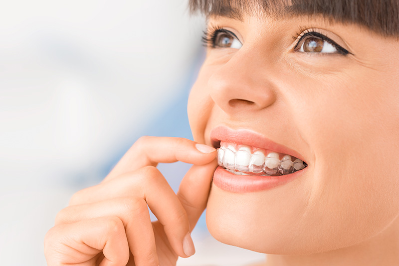 Invisalign in Rockville