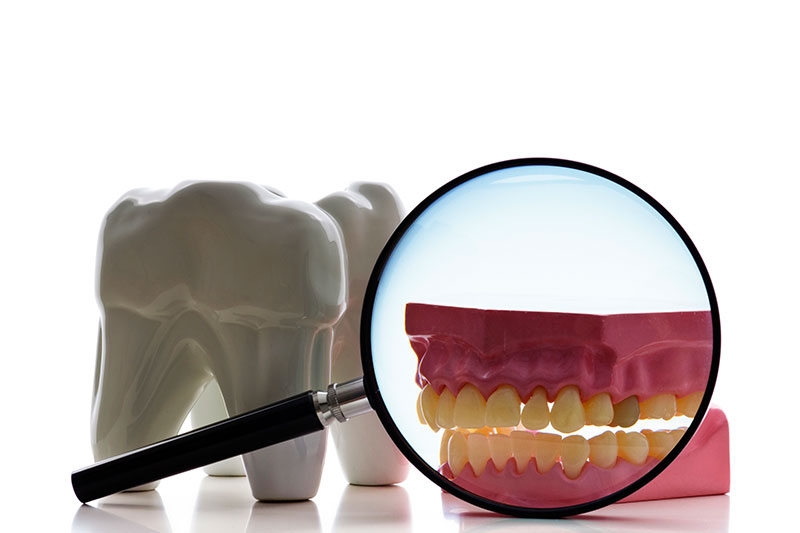 Root Canal Treatment in Rockville