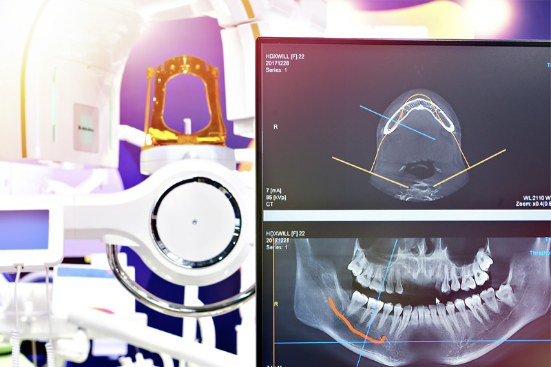 Digital X-Rays in Rockville